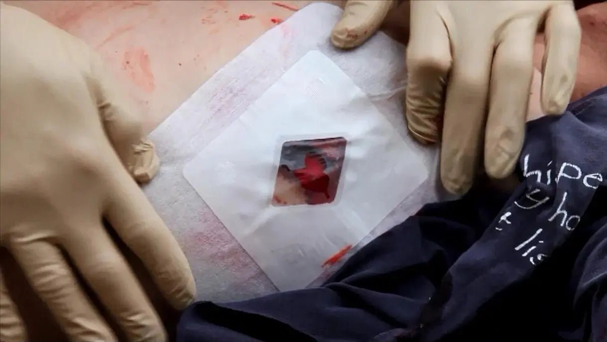 Russell Chest Seal - Safeguard Medical