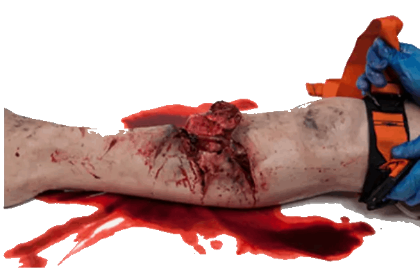 Simbodies Full Leg Major Injury Task Trainer - Simbodies