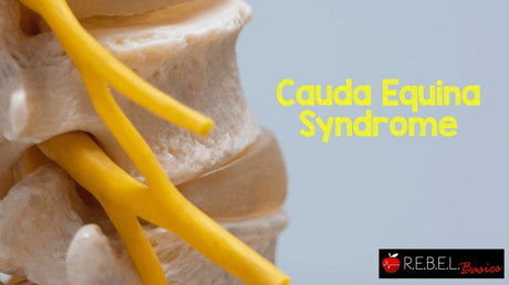 Cauda Equina Syndrome