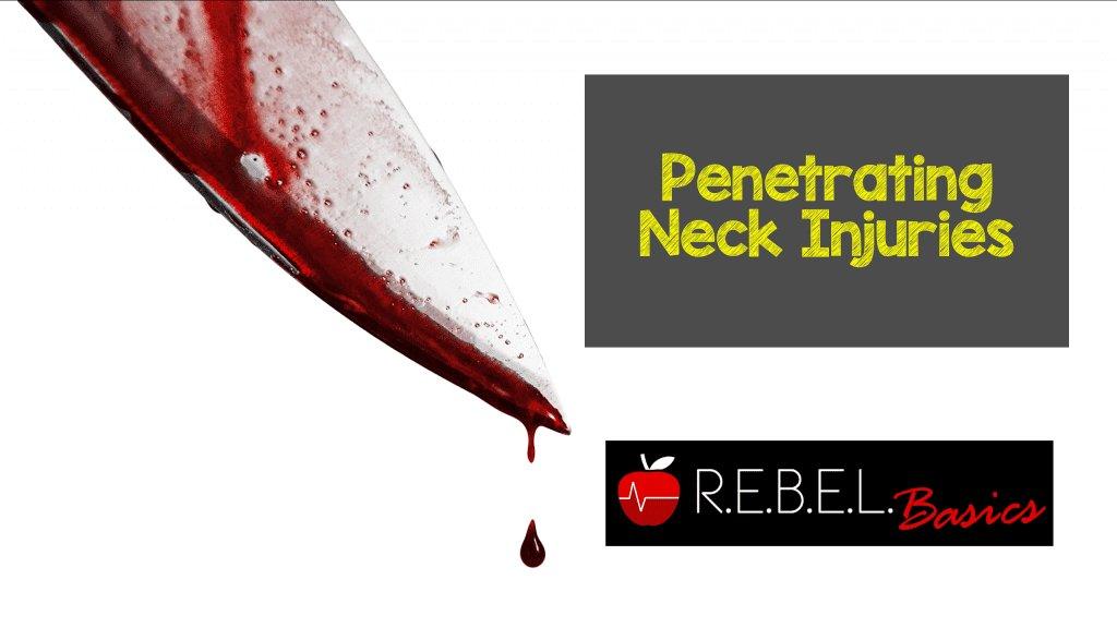 Penetrating Neck Injuries