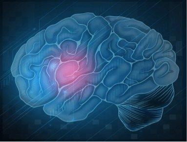 Reversing Anticoagulation to Administer Systemic Fibrinolytics for Ischemic Stroke: Pump the Brakes