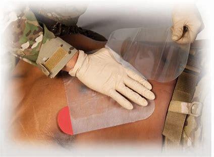 The Essential Role of Chest Seals in Emergency Medical Response - MED-TAC International Corp.