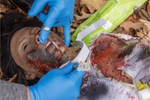 Emergency Cricothyrotomy Kit