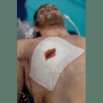 Russell Chest Seal - Safeguard Medical