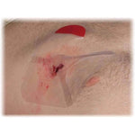 HyFin Vent Compact Chest Seal - Twin Pack - North American Rescue