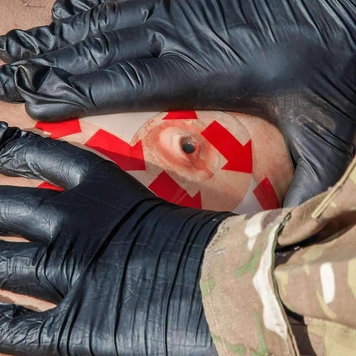 SENTINEL Chest Trauma Kit - Combat Medical Systems